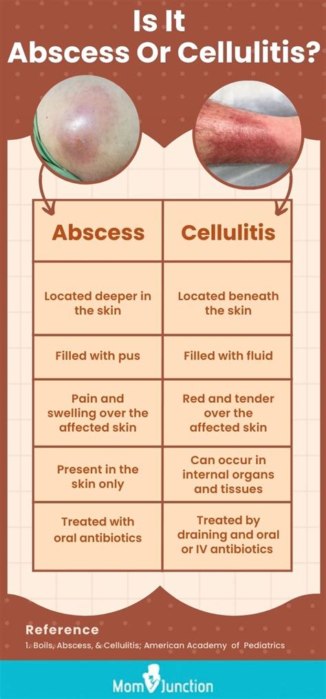 abscess antonyms|More.